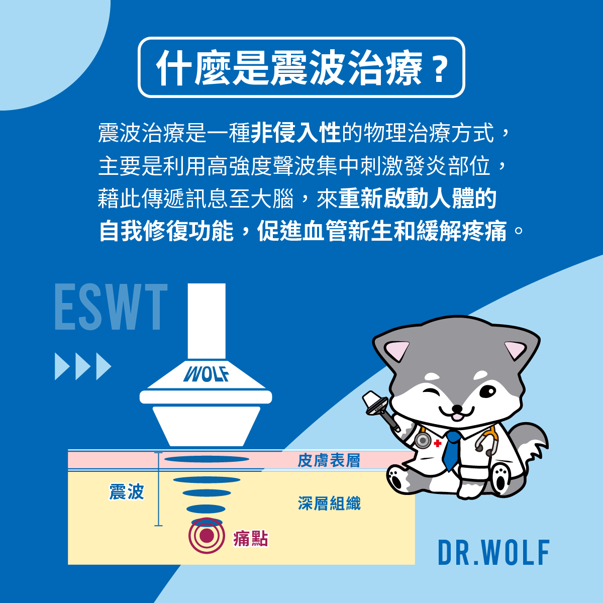 什麼是震波治療 圖卡